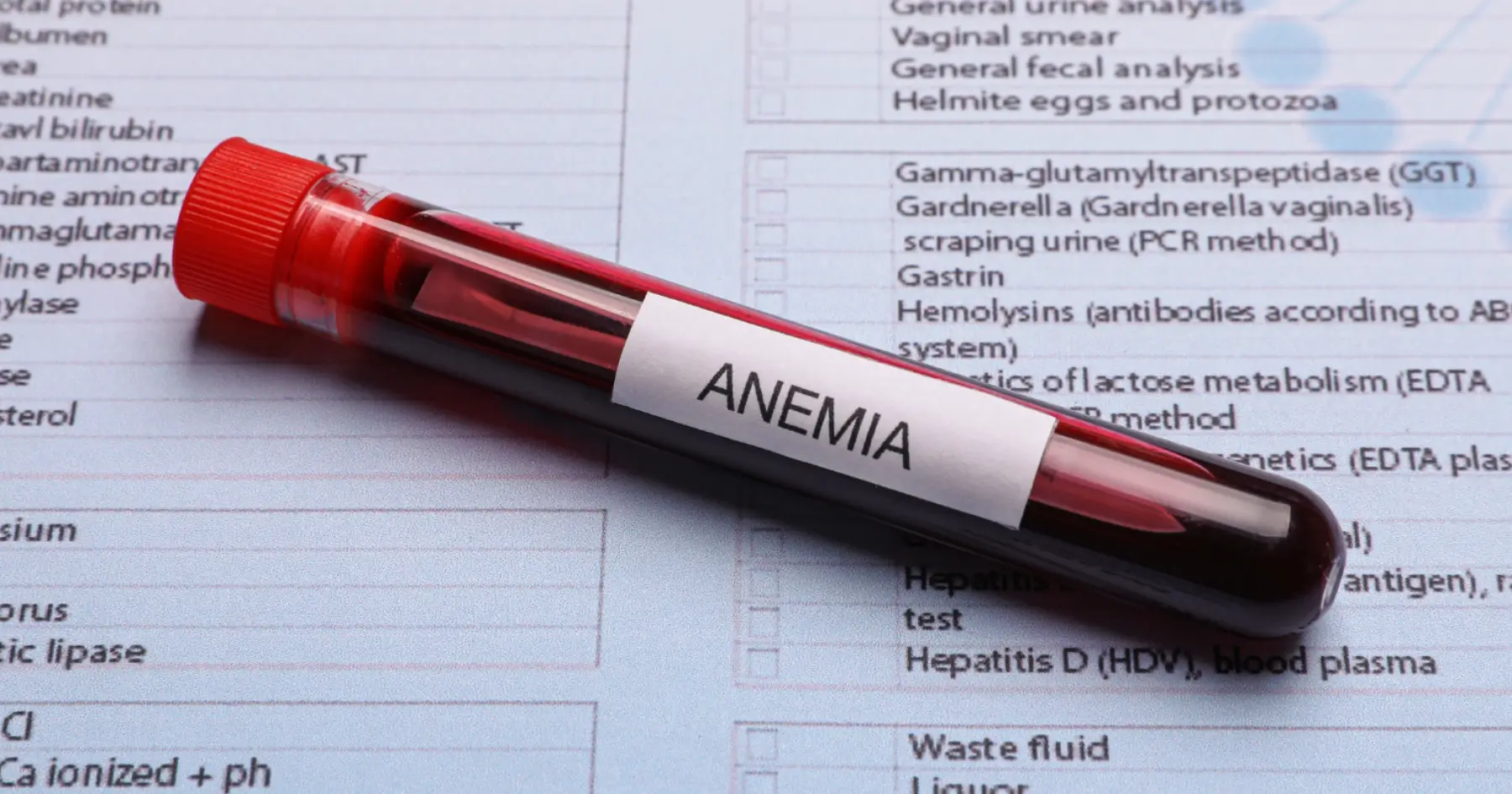 anemia
